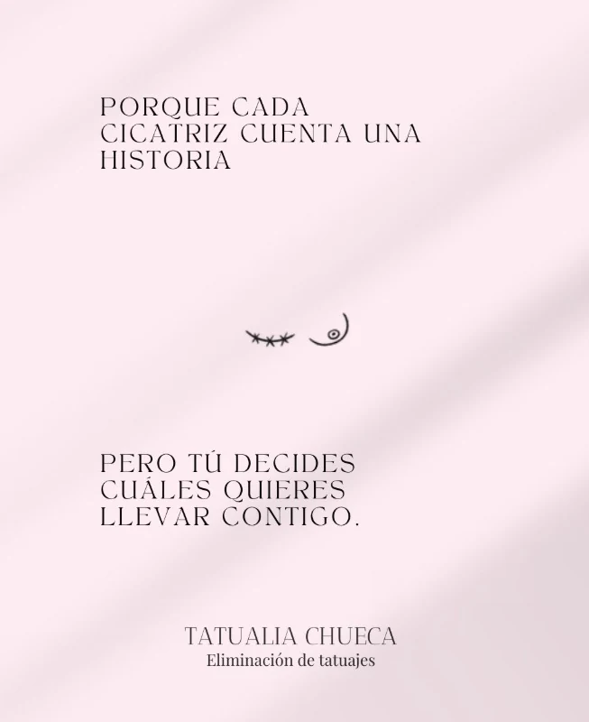 Ilustración en rosa de Tatualia Chueca sobre la eliminación de los puntos de radioterapia