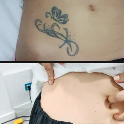 Antes y después: mariposa con filigrana en el abdomen