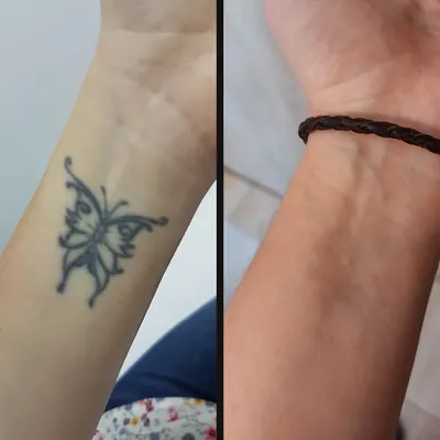 Antes y después: mariposa en la muñeca