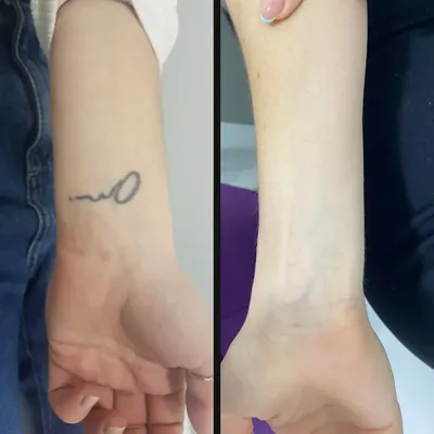 Antes y después: letra en la muñeca