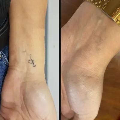 Antes y después: símbolo pequeño en la muñeca