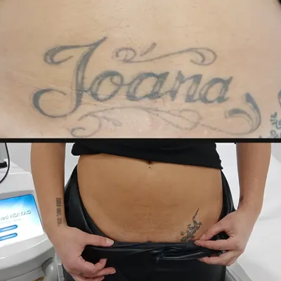 Antes y después: nombre «Joana» en el abdomen