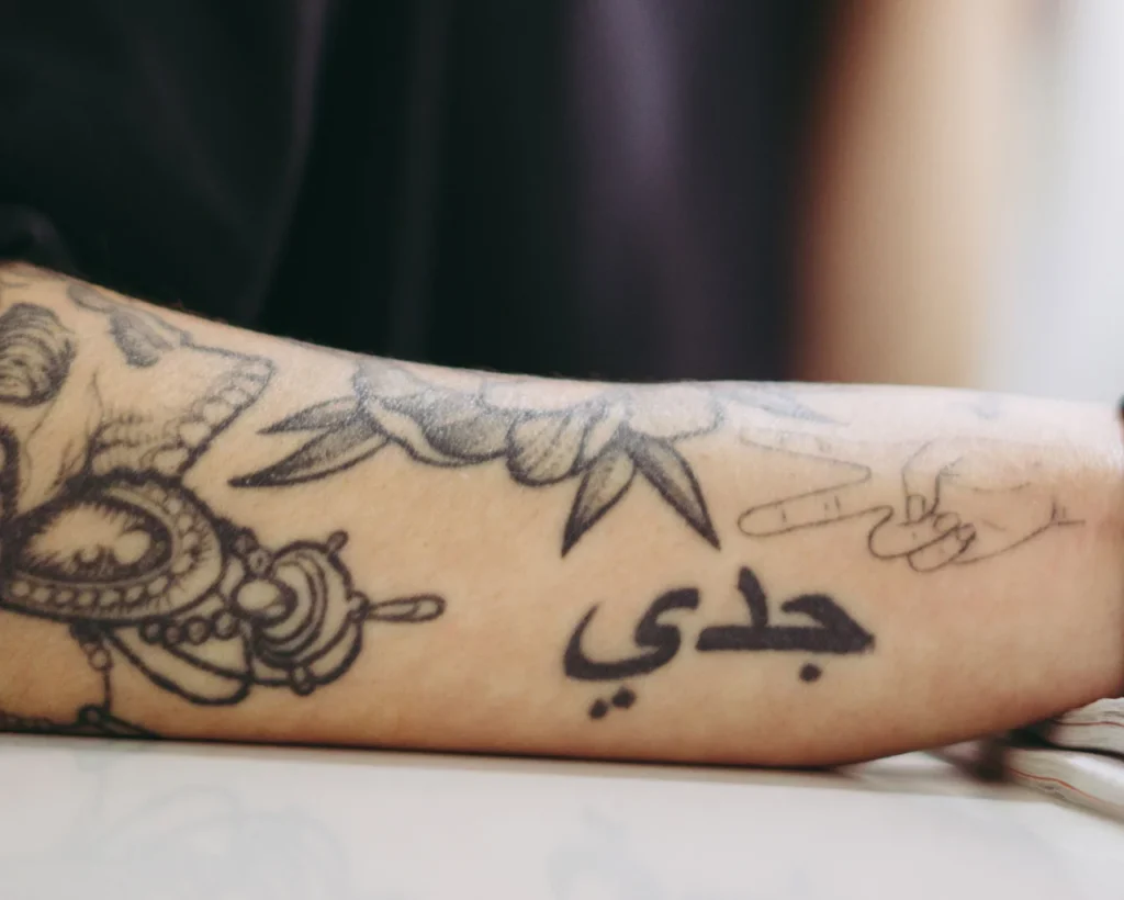 resultados-eliminacion-tatuajes-tatualia-madrid